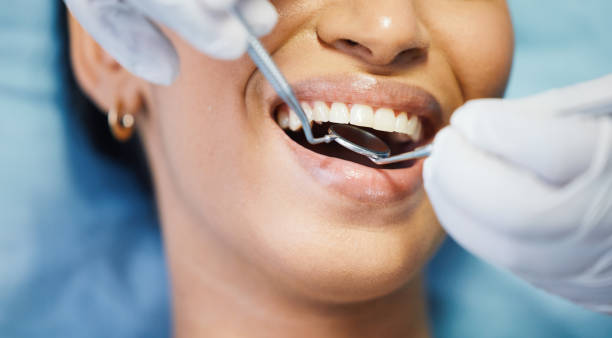 Best Broken or Cracked Tooth Emergency Dentist in Glespie, IL