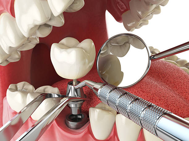 Best Pediatric Emergency Dentist in Glespie, IL